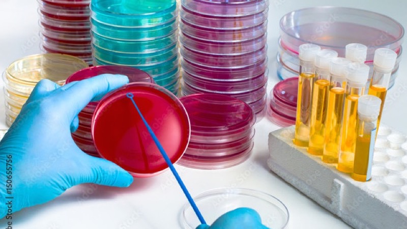 Microbiología y medios de cultivo